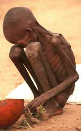 starving-child-sudan