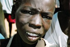 Boy, victim of torture in Darfur