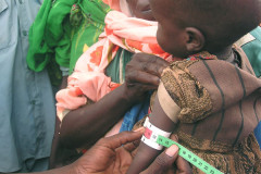 Malnutrition rising sharply in Darfur
