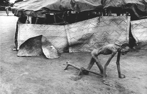 Sudan-1993-–-Famine-victim-in-a-feeding-center-by-James-Nachtwey